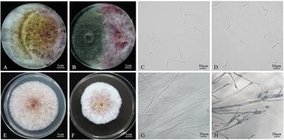 Biological control of Fusarium crown rot of wheat with Chaetomium globosum 12XP1-2-3 and its effects on rhizosphere microorganisms